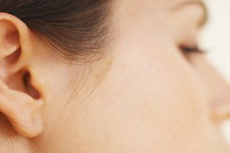 Otoplastia: Cirurgia Plástica Para Correção de Orelhas