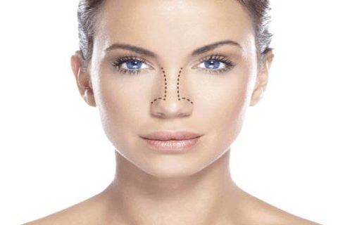 Principais benefícios da Rinoplastia