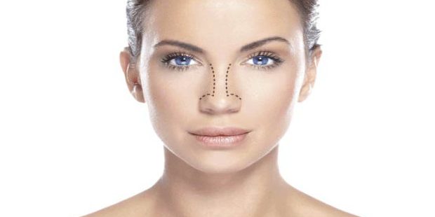 Principais benefícios da Rinoplastia