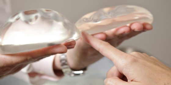 Prótese de Mama tem Validade?