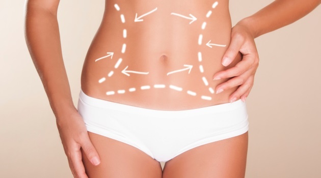 Lipoaspiração ou abdominoplastia? Qual devo fazer?