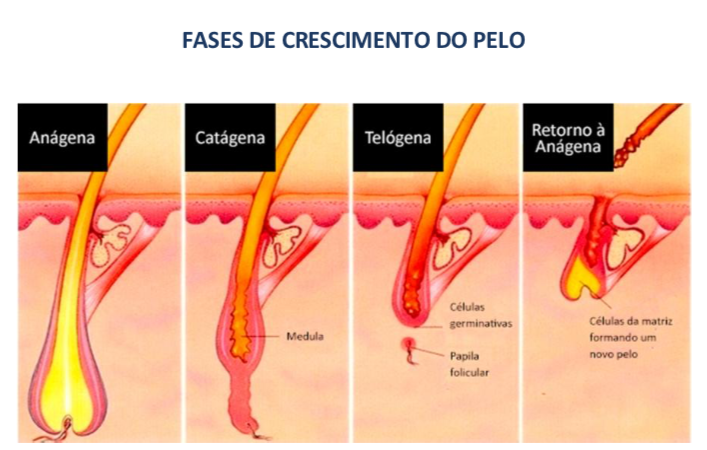 Depilação a Laser