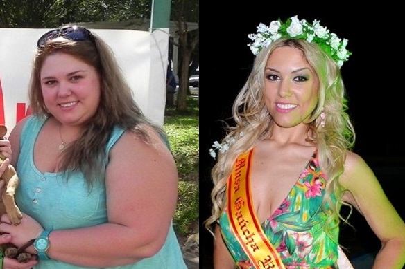 obesidade-antes-e-depois
