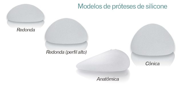 Modelo de Próteses de silicone