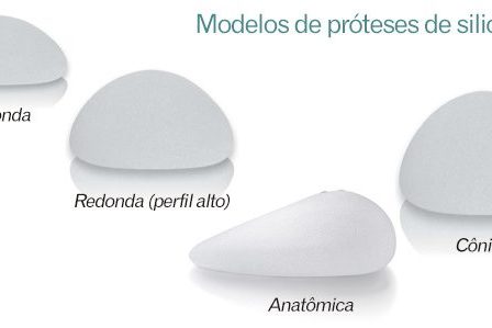 Modelo de Próteses de silicone
