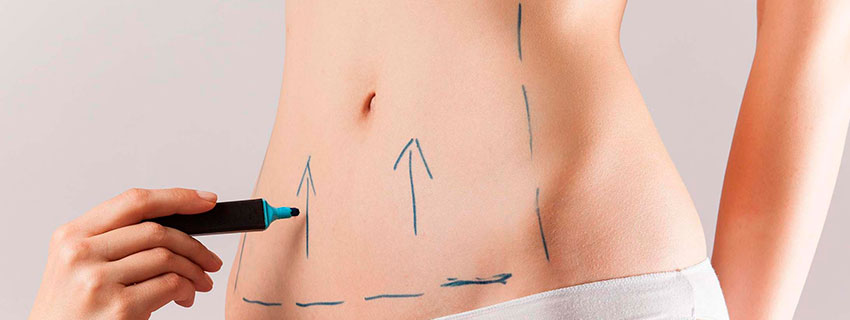 lipoaspiracao e abdominoplastia