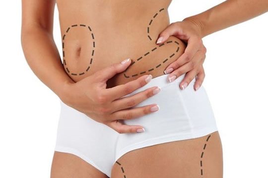 como acabar com a gordura localizada