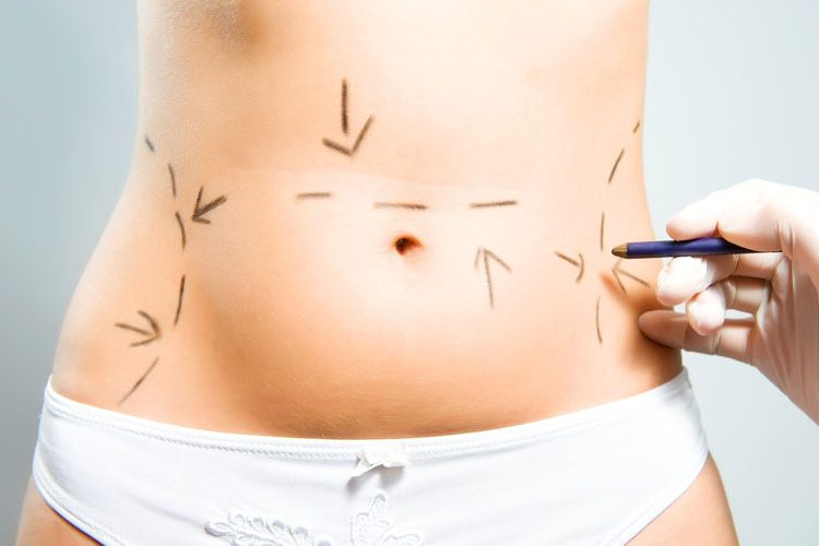 como pagar por uma cirurgia plástica