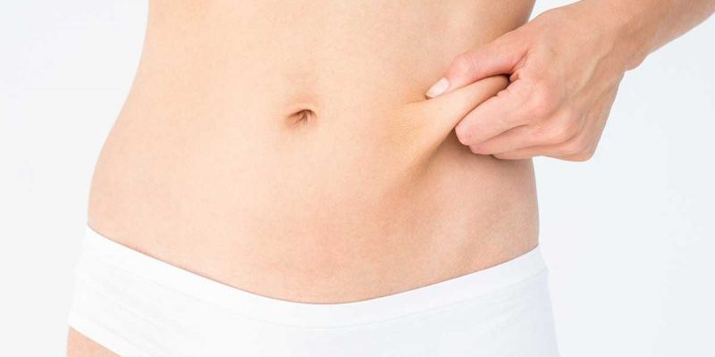 abdominoplastia