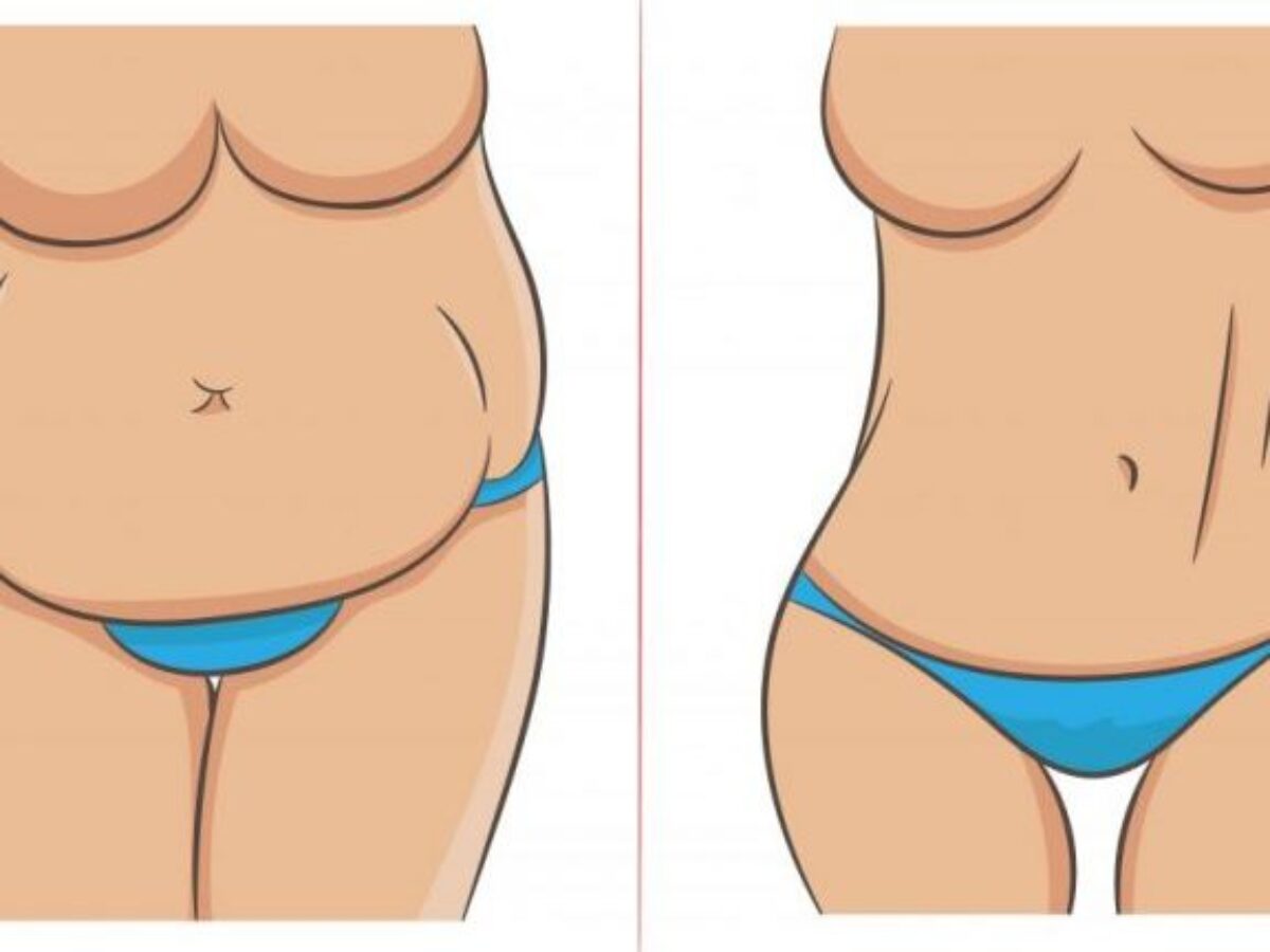 Saiba as dicas sobre o que é um “Mommy Makeover”? UP! Plastica