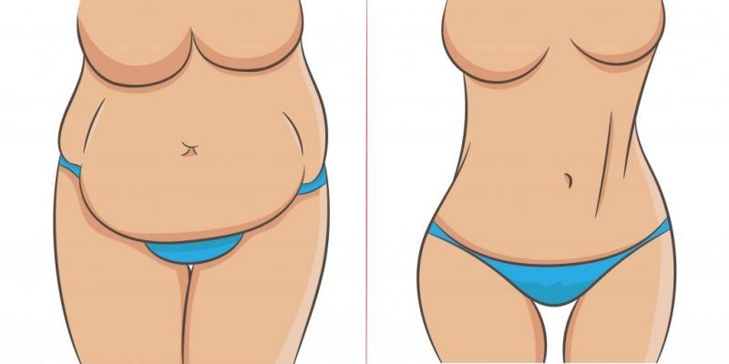 Mommy Makeover Abdomen Antes e Depois