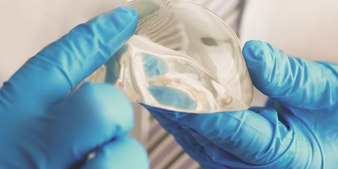 Protese Mama Dúvidas