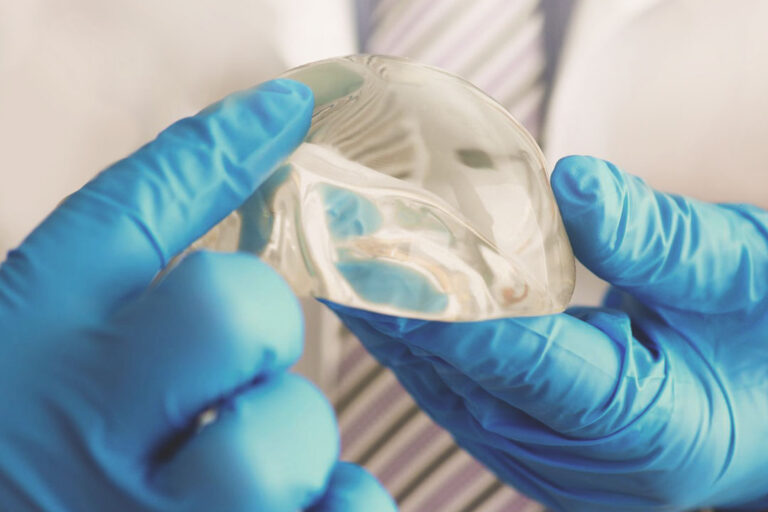 Protese Mama Dúvidas