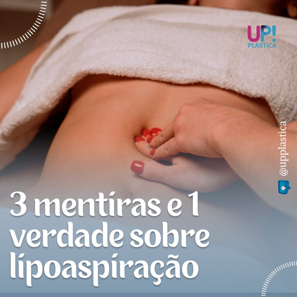 3 Menitras sobre Lipoaspiracao