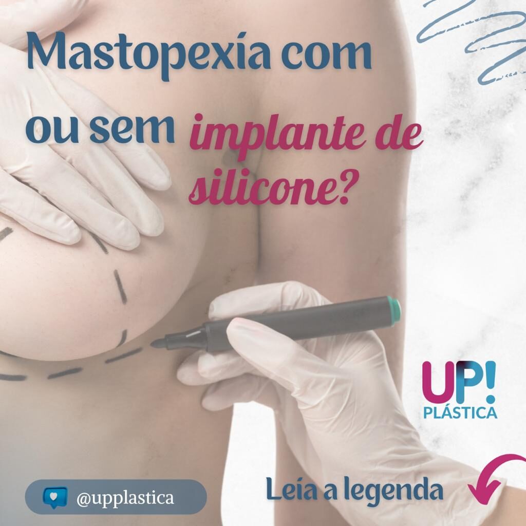 Mastopexia Cirurgia Plastica