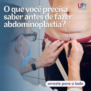 O que você precisa saber antes de fazer o abdomen?